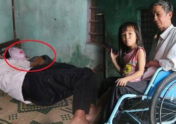 Syok Berat Ditinggal Istri Meninggal Dunia, Pria Ini Tiap Malam Tetap Tidur di Samping Jenazah Pasangannya yang Diawetkan, Lihat Pelukan Romantisnya 