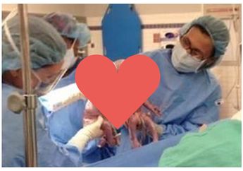 Dokter ini Dibuat Kaget Bukan Kepalang Setelah Lihat Bayi Kembar yang Dilahirkan Pasiennya, Sang Ibu Pun Senang Saat Melihatnya