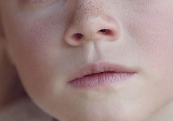 Pernah Alami Kedutan di Pipi Kiri, Begini Makna Mitosnya Menurut Islam