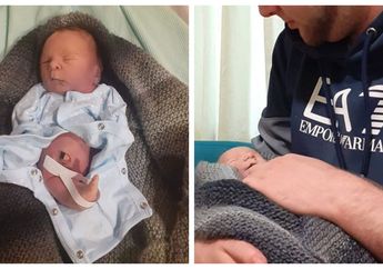 Kisah Memilukan Seorang Bayi Berusia 1 Hari Meninggal Dunia di Pelukan Sang Ayah, Dokter Sempat Mengira 'Si Bayi Ajaib' Tak Akan Bertahan Selama Itu karena Kondisinya Ini