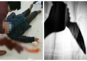  Brutal, Wanita 71 Tahun dan Seorang Anak Ditusuk saat Orang-orang Berebut Desinfektan Demi Hindari Virus Corona