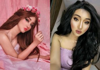 Ngaku Habiskan Rp 1,5 Miliar Demi Jadi Barbie Hidup, Ternyata Kepala Lucinta Luna Pernah Dibelah sehingga Ketergantungan Konsumsi Obat Pereda Rasa Sakit Usai Operasi Cangkok Rambut!