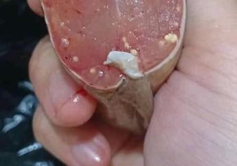 Viral Ikan Lele Dipenuhi Bintik-bintik Putih dan Disebut Mengandung Cacing, Simak Kebenarannya Serta Ketahuilah Bagaimana Ciri Ikan yang Berbahaya Berikut Ini!