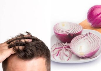 Hilangkan Uban Hanya dengan Bahan Alami Menggunakan Bawang Merah, Begini Rahasianya!