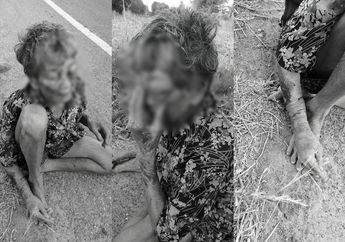 Duduk Lemas di Pinggir Jalan dengan Tubuh Penuh Luka, Nenek Ini Ceritakan Kisah Pilu yang Dialaminya, Pilih Tidur di Jalan Gegara Tak Sanggup Menahan Siksaan dari Cucunya