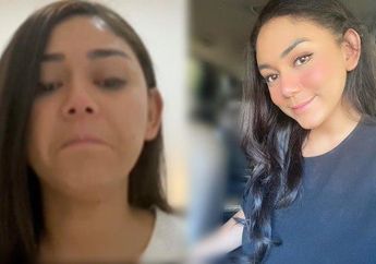 Idap Tumor Tiroid, Thalita Latief Minta Maaf dan Mohon Didoakan