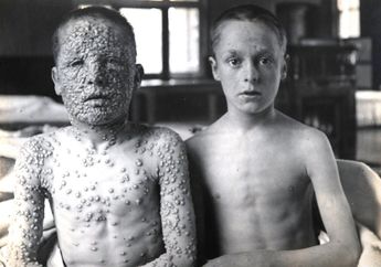 Membunuh 30 Persen Penduduk Dunia Hingga Dijadikan Senjata Biologis Perang, Inilah Pandemi yang Berhasil Dijinakkan Manusia, Orang-orang Sekarang Justru Bersyukur Pernah Terinfeksi Penyakit Ini