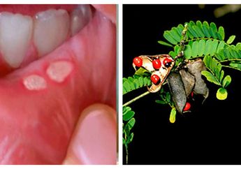 Manfaat Daun Saga untuk Sariawan, Yuk Obati Sariawan dengan Daun yang Satu Ini! Jangan Membiarkannya Berubah Jadi Penyakit yang Lebih Berbahaya