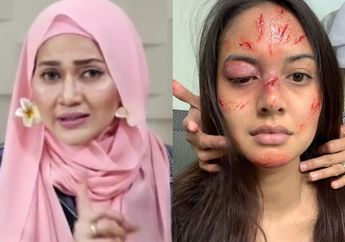 Heboh Challange Pamer Wajah Bonyok, Psikolog Poppy Amalya Justru Beri Kecaman: Tanpa Sadar Memperlihatkan Kepribadian Sadisme!