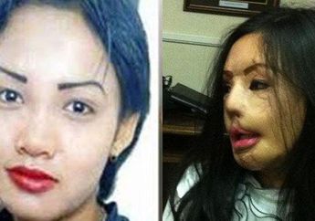 15 Tahun Lalu Disiram Air Keras oleh Suami Lantaran Cemburu, Nasib Lisa Face Off Kini Berubah Usai Jadi Pengusaha Langganan Konglomerat