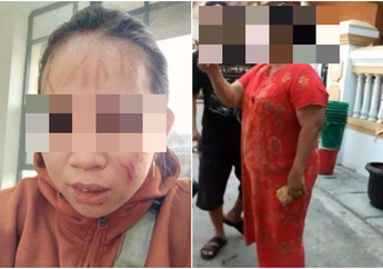 Cakar-cakaran dengan Ibu RT Gegara Bansos Pandemi Virus Corona, Wanita di Bekasi Ini Viral Hingga Lapor Polisi