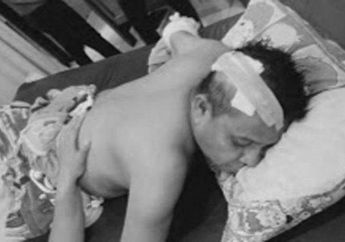 Banting Tulang Cari Nafkah Malah Diledek, Kades Bersimbah Darah Dibacok Warganya Lantaran Sakit Hati