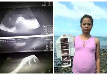 Bikin Geger Sekampung, Wanita Ini Dipercaya Hamil Seekor Ikan Gara-gara Langgar Pantangan Ini, Tapi Dokter Ungkap Fakta Mengejutkan