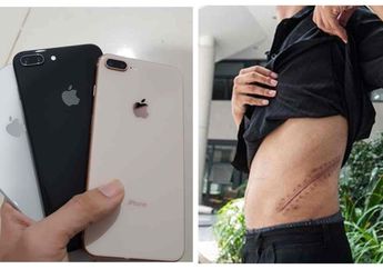 Rela Jual Ginjal Hanya Buat Beli iPhone 9 Tahun Kemudian Remaja Ini Menyesal, Kondisinya Mengenaskan dan Hidup dalam Kondisi Sakit-Sakitan