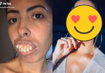 Viral Video Perubahan Drastis Seorang Wanita Setelah Nikahi Ahli Bedah Gigi, Terungkap Fakta di Baliknya yang Bikin Kesel