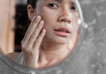 Terkuak! Ternyata Ini 5 Penyebab Berjerawat Meski Kamu #dirumahaja, Salah Satunya dari Kebiasaan Malas Membersihkan Wajah
