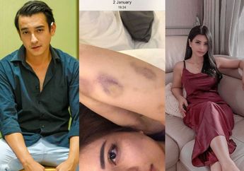 Pesinetron Ini tak Bosan-bosannya Lakukan KDRT, kini Giliran Mantan Istri Sirinya Aska Ongi yang Kena, Hobi 'Jajan' pula!