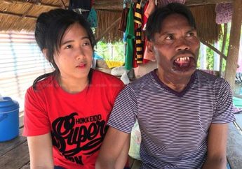 Pilih Nikahi Pria Berwajah Tak Lazim, Janda Cantik Ini Banjir Cibiran, Terukuak Nasib Pernikahan Keduanya yang Buat Syok