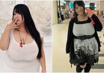 Dijului Payudara Terbesar di Jepang Karena Ukurannya 120 Cm, Wanita Ini Justru Mengaku Tersiksa Memiliki Payudara Besar, Sering Alami Sakit Pada Bagian Ini
