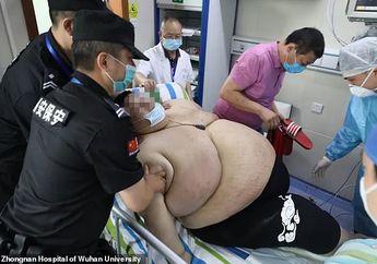 Akibat Lockdown Selama 5 bulan, Berat Badan Naik Jadi 279 Kg! Pria Ini Dinobatkan Jadi Manusia Terberat di Wuhan