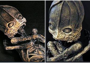 Dikira Alien Karena Wujudnya Mengerikan, Makhluk Ini Ternyata Bayi Manusia, 23 Tahun Kemudian Terungkap Penyebab Wujudnya Menjadi Mengerikan