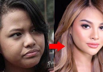 Hidupnya Makin Nelangsa Usai Disia-siakan KD, Aurel Hermansyah Ngaku Sakit Hati Sampai Mogok ke Sekolah Gegara Penampilan Lusuhnya Dihina: Aku Dikatain Jelek!