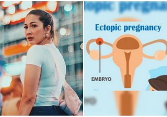 Mengenal Kehamilan Ektopik yang Hampir Merenggut Nyawa Andrea Dian, Waspada! Kenali Tanda-tandanya