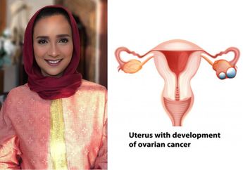 Sekarang Terlihat Cantik dan Sehat, Siapa Sangka Shahnaz Haque Pernah Menderita Kanker Ovarium! Penyakit Mematikan yang Sering Tidak Terdeteksi