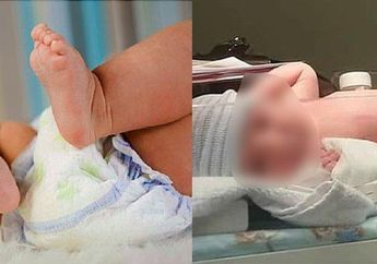 Nahas, Bayi 4 Bulan Ini Tewas Mengenaskan karena Popoknya tak Diganti selama 14 Hari hingga Muncul Belatung, Orangtuanya malah Sibuk Kecanduan Sabu