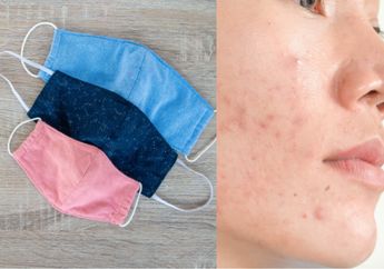 Pakai Masker Kain Bisa Bikin Jerawatan! Simak Cara Mencegah Jerawat Akibat Masker Kain dari Pakar Estetika