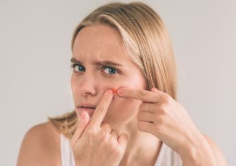 Cuma dalam Semalam, Jerawat Kempes dengan 5 Pilihan Obat Jerawat Ampuh Ini!