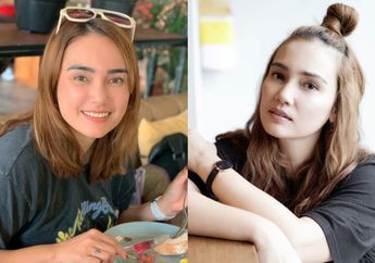 Mati-matian Lawan Penyakitnya, Feby Febiola Curhat Rela Cukur Rambut hingga Nyaris Botak Gegara Bolak-balik Jalani Kemoterapi : Terharu Banget atas Doa-doa Kalian