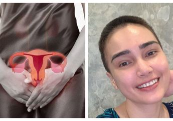Waspada! Kista Ovarium seperti yang Diidap Feby Febiola Bisa Tumbuh Tanpa Rasa Sakit, Ini Tanda-tanda yang Wajib Wanita Ketahui agar Ovarium Tak sampai Harus Diangkat