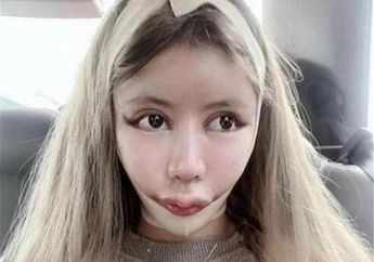 60 Kali Operasi Plastik, Wajah Wanita Ini Bikin Merinding Gegara Bolak-balik Dibedah, Kini Beda Jauh dengan Paras Aslinya