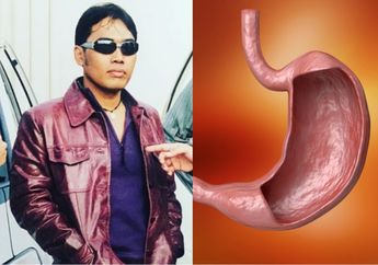 Renggut Nyawa Basis Dewa 19 di Usia 48 Tahun, Ternyata Pendarahan Lambung Tidak Bisa Dianggap Sepele, Kenali Gejalanya yang Mirip Anemia Ini!
