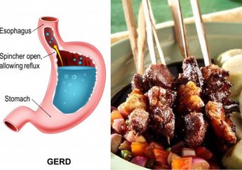 Awas! Jangan Kalap Makan Daging Kambing, Kalau Ngeyel Bisa Mengundang 3 Penyakit Ini, Salah Satunya Gerd