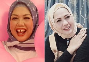 Lakukan Sulam Lesung Pipi Hingga Potong Gigi Untuk Rombak Wajahnya, Intip Penampilan Elly Sugigi yang Bikin Pangling!