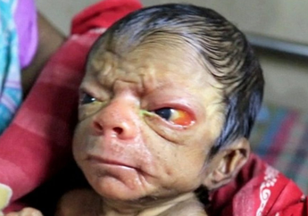 Geger di Ruang Operasi! Gara-gara Bayi yang Baru Dilahirkan ini Miliki Tampang yang Tidak Biasa, Bagaimana Reaksi Orangtuanya