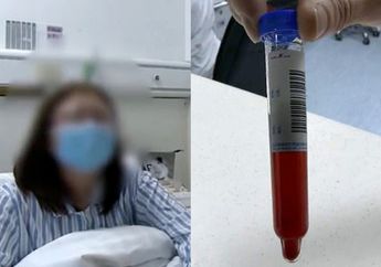 Sudah Lelah Tapi Masih Ngotot Lanjut Olah Raga, Wanita Ini Harus Telan Pil Pahit karena Urinnya Berubah Warna Jadi Cokelat