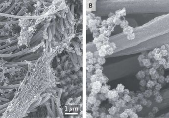 Mengerikan! Begini Penampakan Virus Corona Saat Menyelimuti Sel Paru-paru Manusia