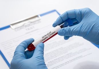 Bermula dari Puluhan Santri Terindikasi Anosmia, Dinas Kesehatan Kota Salatiga Temukan Tambahan Kasus Covid-19 Sebanyak 109 Pasien dari Pondok Pesantren di Kecamatan Sidorejo