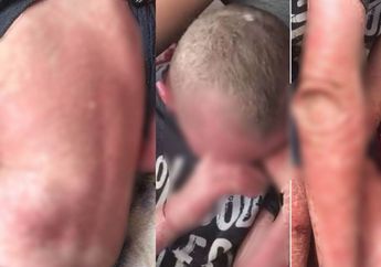 Bocah 9 Tahun Curhat Lebih Baik Mati Usai Divonis Penyakit Langka yang Membuat Kulitnya Berjatuhan, Dokter Sampai Angkat Tangan