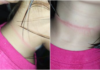 Ikut-ikut Aksi di Video TikTok, Bocah 4 Tahun Nyaris Tewas Usai Tiru Adegan Gantung Diri