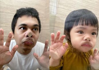 Pamer Wajah Super Lucu Anak Perempuannya yang Centil Kempit Tas Mungil, Raditya Dika: Ekspresi Alea Ketika Diroasting Bapak Sendiri
