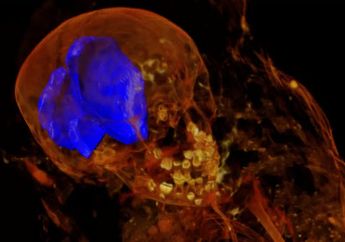 Bongkar Mumi Mesir Kuno, Peneliti Terkejut Setelah Lakukan Scan Sinar-X Menemukan Fakta Mengejutkan Ini Tentang Identitas Mumi Tersebut