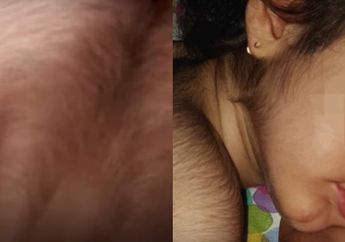 Banyak Anak di Spanyol Mendadak Terkena Sindrom Manusia Serigala, Ternyata Penyebabnya karena Hal Ini