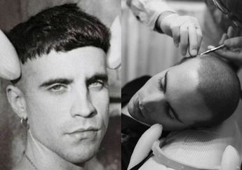 Coba Hal Gila, Seniman Muda Ini Nekat Tanamkan Sirip ke Tengkoraknya dan Membuat Dirinya Memiliki Kemampuan Unik Ini