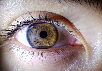 Mengenal Retinopati Diabetik, Gangguan Mata Pada Pasien Diabetes Mellitus