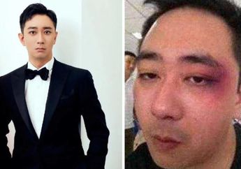 Mengaku Pernah Alami KDRT, Aktor Tiongkok Ini Cerita Sempat Ditampar Mantan Istrinya 500 Kali hingga Disundut Puntung Rokok