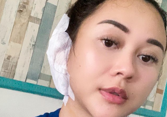 Aura Kasih Curhat Habis Operasi Pecah Gendang Telinga, Simak Gejala-gejala Gendang Telinga Pecah Ini